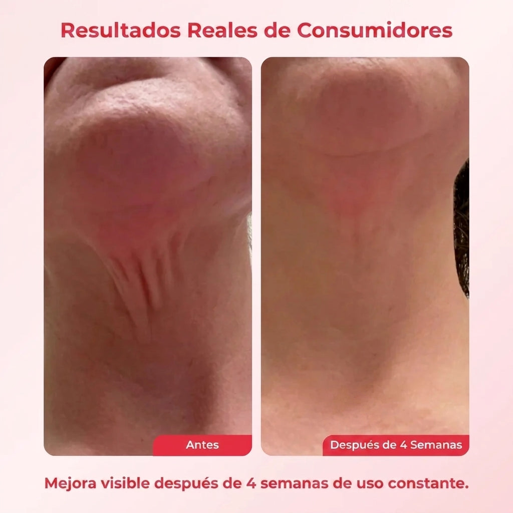 Koriderm™ Time Reverse crema para el cuello